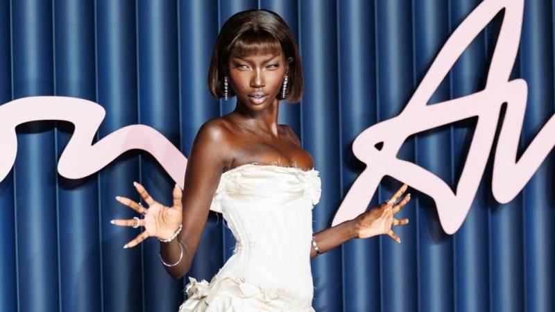 Model Anok Yai sessizce mücadele ettiği hastalığını açıkladı!